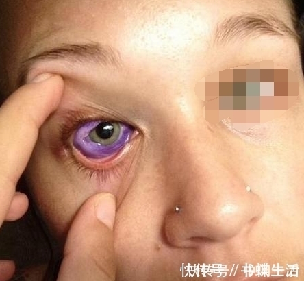 紫色|国外一女子，哭出来的是紫色眼泪，医生查出真相原因是纹身