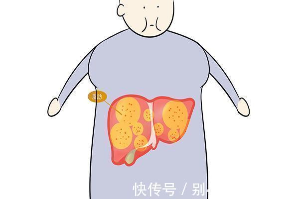 向心性肥胖|肚子特胖的人，肚里都是什么教你几招，减去大肚腩，瘦成小细腰