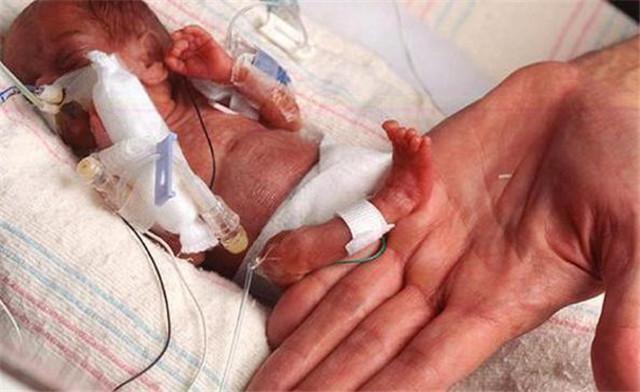 童话|童话里的“拇指姑娘”走进现实,一出生仅25厘米,如今美出泡儿