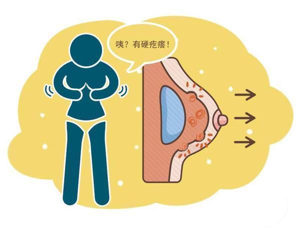 乳头|体内有癌，胸部先知？女性胸部若有4个迹象，需尽早排查乳腺癌