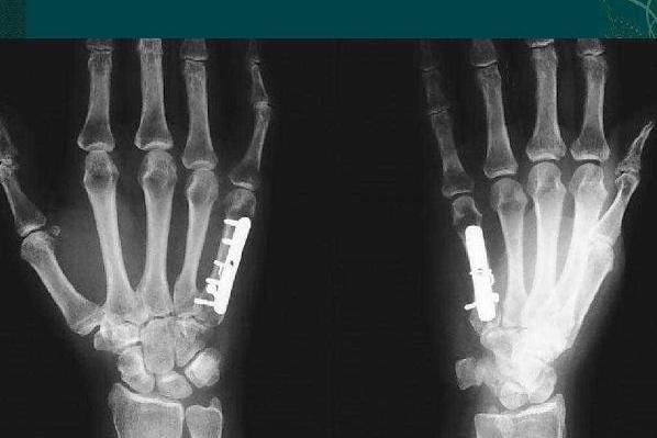 過半百的人若身體還有以下三個特征，恭喜了！長壽在悄悄降臨