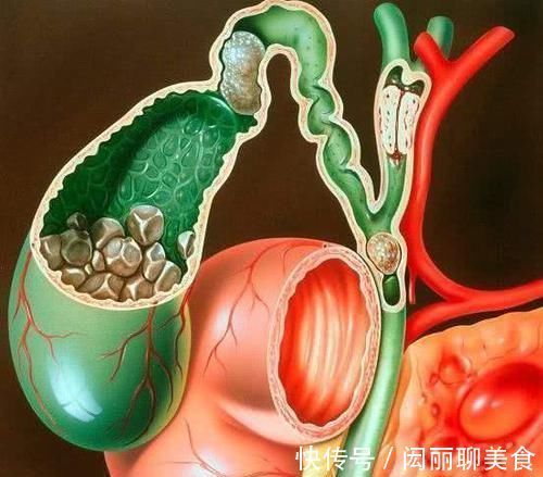 多梦|经常失眠、多梦、口干、口苦?这三个原因是“幕后推手”,要注意
