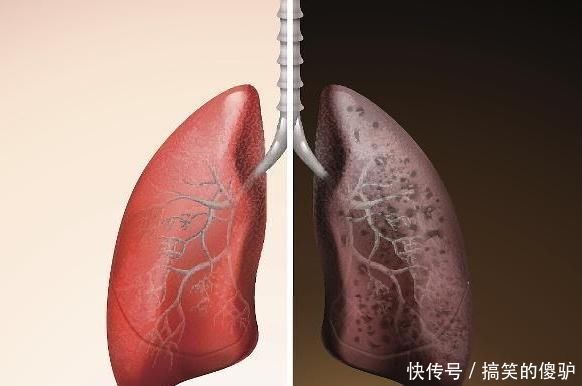 润肺|它是肺部“清洁工”,坚持泡水喝,润肺通便,肺会更“舒服”!