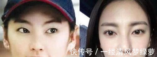 中国人|双眼皮现在还流行吗,你到底适不适合双眼皮,一起了解一下吧