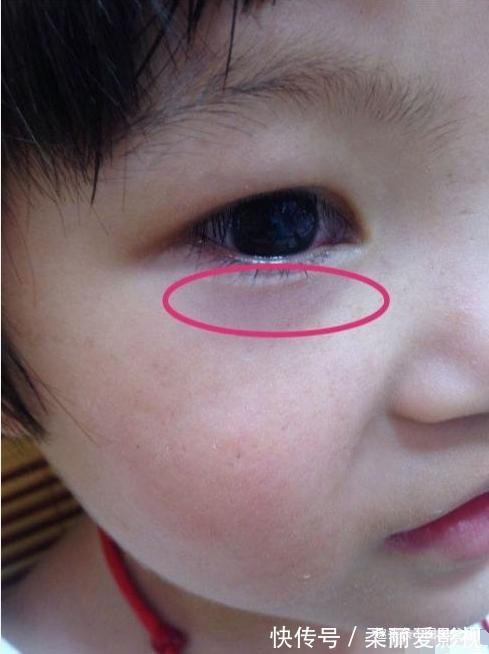 儿科医生|婆婆带娃6年,没进过医院,只因不吃2饭,多做2事,孩子脾胃好!