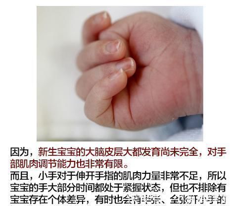 口水疹|郎朗晒娃又被批?这次冤枉!新手准爸妈还有哪些母婴常识需注意?