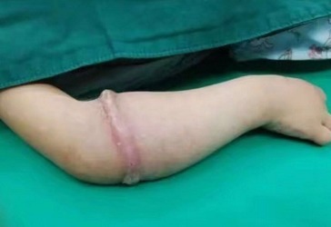 爷爷奶奶|4岁女孩总喊手臂疼,送到医院检查后,医生再晚就来不及了