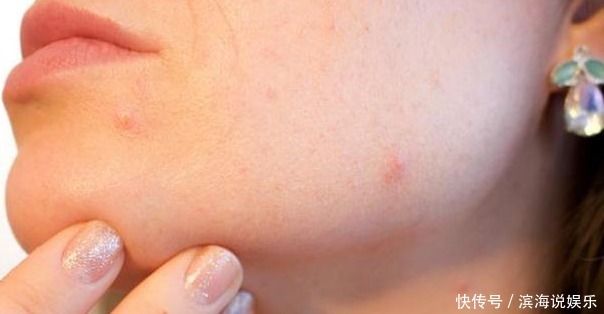 “肝毒”太深,“脸上”有3种表现,排除肝毒,按一穴、吃三蔬