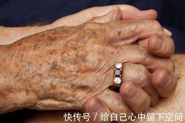 抗衰老|几种清除老年斑的方法,学会任意一个,或能让老年斑慢慢消失