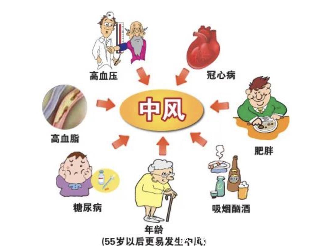 中风|哪些人群容易出现小中风呢?