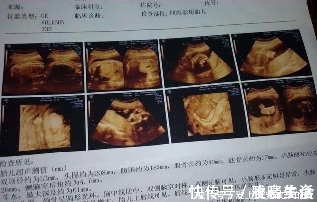 正常值|四维彩超,孕妈们最期待的产检,除了看宝宝的照片还需要看什么?