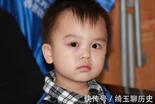 叶女士|双眼皮能揉出来?3岁男童视网膜脱落,只因妈妈的“双眼皮执念”