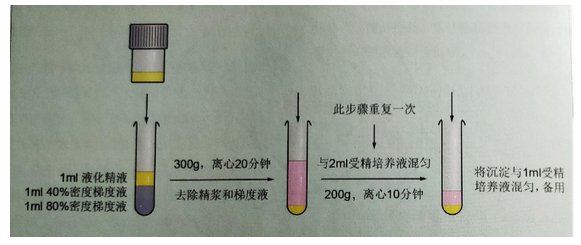 精子|【孕育新生】常用精液处理方法简介