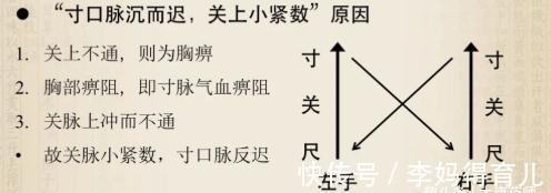 名方|医圣张仲景：一个治心脏病的千古名方，横扫冠心病、心绞痛、心梗