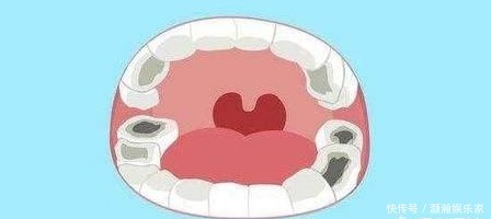 缺钙|如果宝宝1岁还没长牙，这是缺钙吗应该怎么办