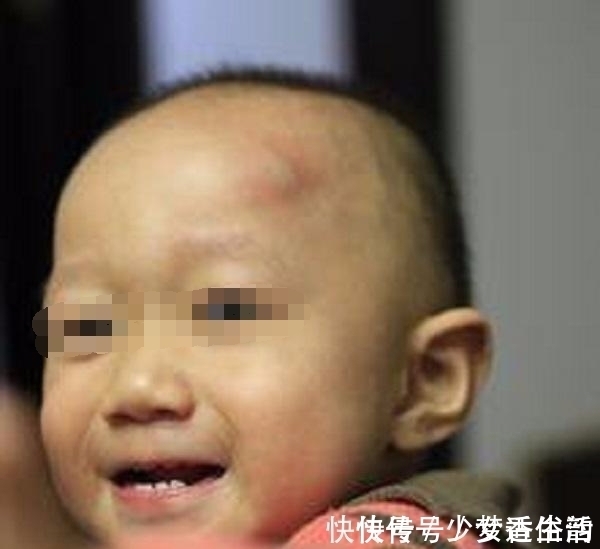 婆婆|2岁宝宝头上磕个包,婆婆嫌弃妈妈大题小作,事情结果让全家崩溃
