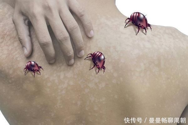 半个月|被褥半个月不换洗,螨虫上“百万”,教你除螨方法,减少危害