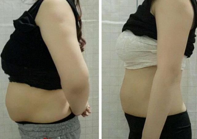 瘦胃|减肥前先瘦胃,吃饭时牢记3原则,胃变小了,你也更易瘦下来