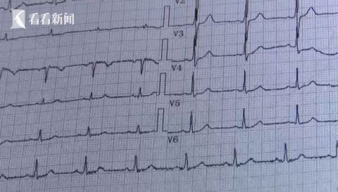 医生|女子怀胎8个月肚里突然没动静医生一查惊呆了
