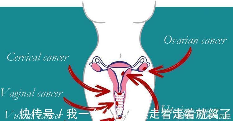 下腹部|关于女性慢性下腹痛,想知道有哪些常见原因吗?医生直接告诉你