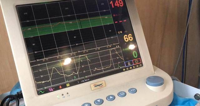 腰椎针|剖腹产就是打一针睡一觉看看这根腰椎针的长度，还仅仅是个开头