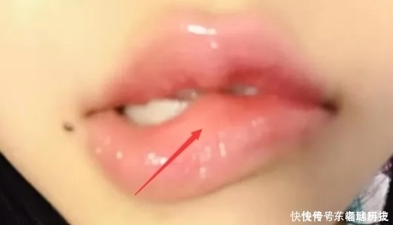 学生党“贼伤嘴巴”的3动作，多数00后已中招，变“火锅嘴”可别哭