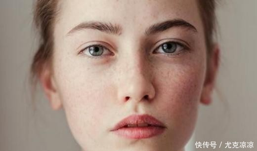 食物|三位院士建议:祛斑其实很简单,2种食物换着食,色斑绕你走