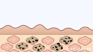 女孩|那些坚持涂身体乳的女孩,皮肤都怎么样了