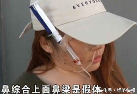 女子高价整容,脸上挂满“注射器”,医院:赔你点吧