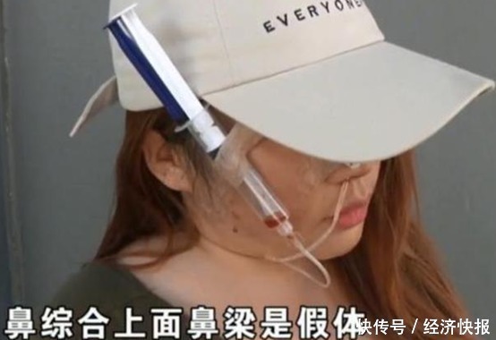 女子高价整容，脸上挂满“注射器”，医院：赔你点吧