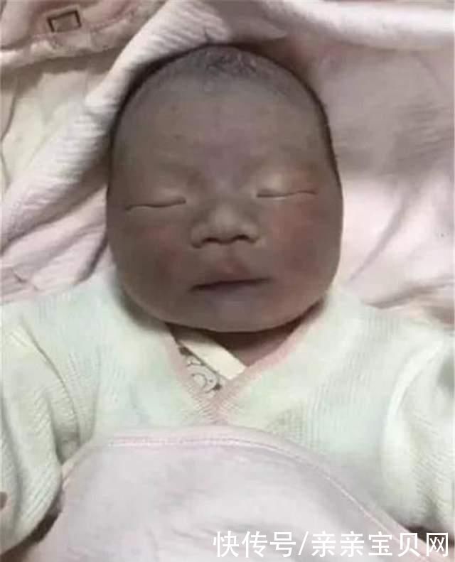 宝妈|宝妈生下“黑脸宝宝”，家人纷纷嫌弃丑，2个月后宝宝完美逆袭