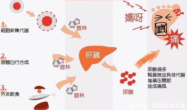 给尿酸高的人提个醒这4种食物比海鲜嘌呤还高,建议能避则避