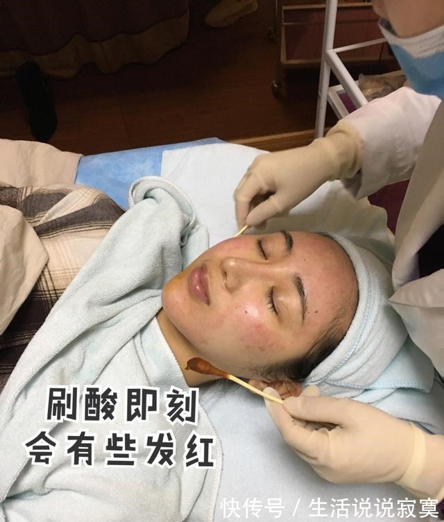 护肤品 果酸术后超全护理大全!