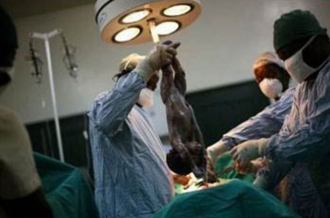 双胞胎|女子五年生了12个娃,给她接生的医生笑了!