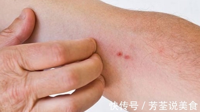 肝脏|肝硬化走来,记准“1痒2黄3舌”,肝脏“求救”,别当看不见