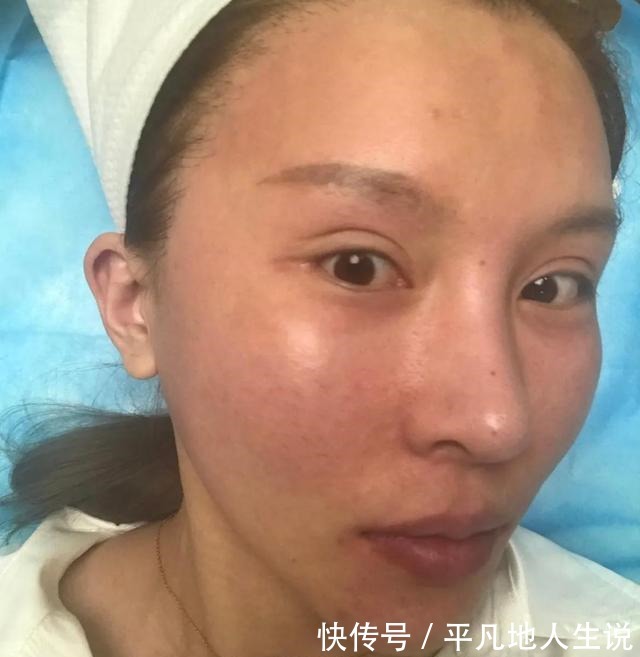 医美 皮肤不好,做医美真的能把皮肤做好吗!