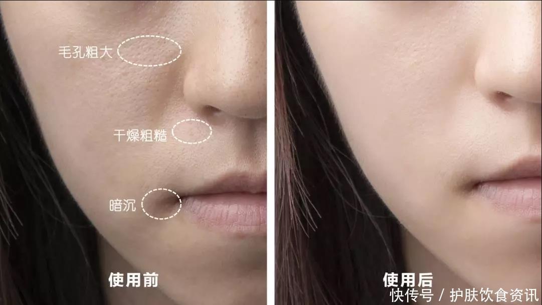 育龄期|28岁+女性选择什么胶原蛋白产品好?