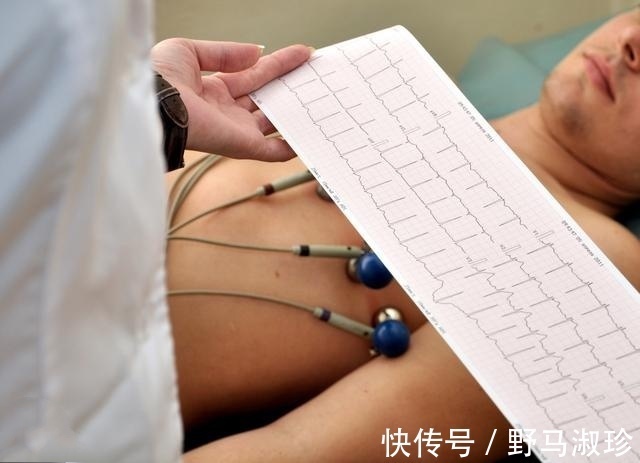 高血压|高血压的人心率控制在多少最理想呢医生这次告诉您最佳心率！