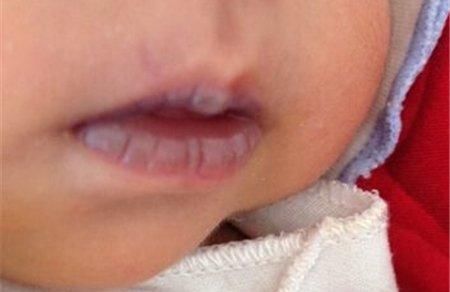 杨晓|小儿推拿杨晓:当宝宝出现这些信号,就说明孩子的脾胃出了问题!