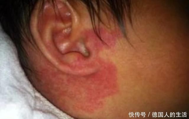 宝宝|孕妈在孕期,尽量不做4件事,避免宝宝脸上长胎记,孕妈别不在意