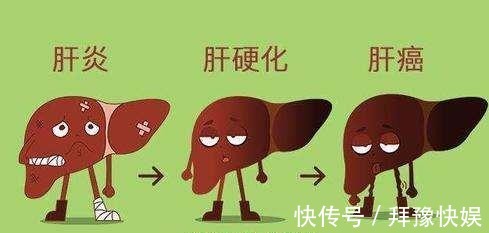 发痒|常吃3种调料的人，注意了！若身体2处发痒，可能是肝变硬的信号