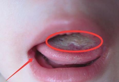 助长器|13岁男孩一年长高15公分,医生透露:1物是身高的助长器,可多吃