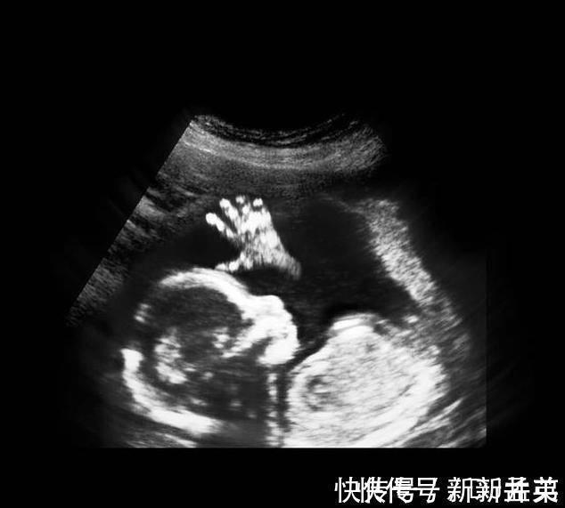 羊水|胎儿从卵泡到性别形成,17张图片清晰诠释,男宝女宝看得很清楚