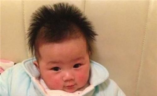 营养均衡|宝宝头发为啥总是竖着长?这三种情况对照一下,早发现早改善!