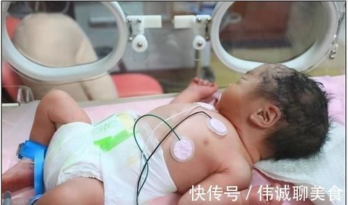 剖腹产|经过了一夜的待产,终于要跟宝贝见面了,我的剖腹产记录