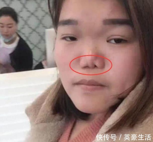 鼻子|最“毁鼻子”的3行为,学生党却成习惯,占一个异性缘就会归0哟!