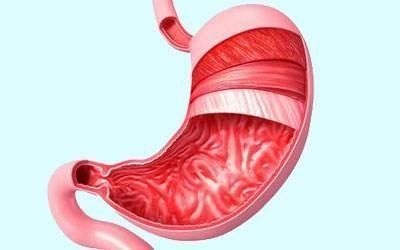 胃炎怎么办，多吃“4宝”，修复胃黏膜，现在知