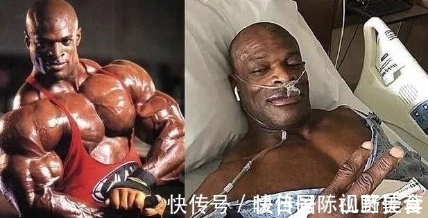 手术|世界健美冠军曾获奖无数,如今经历七次手术,连走路都很困难