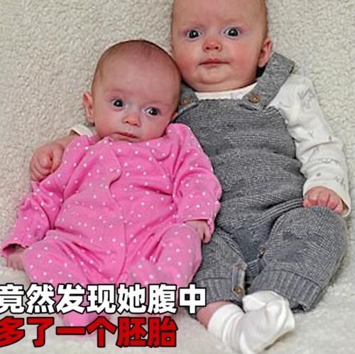 美芽|女子怀孕三周后又怀上一个孩子,单胎变双胞胎,医生也是头一次见