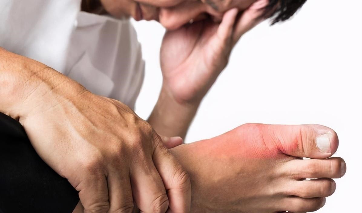 嘌呤|男子高尿酸变成肾衰竭,从不喝酒,医生指出2样东西害人不浅